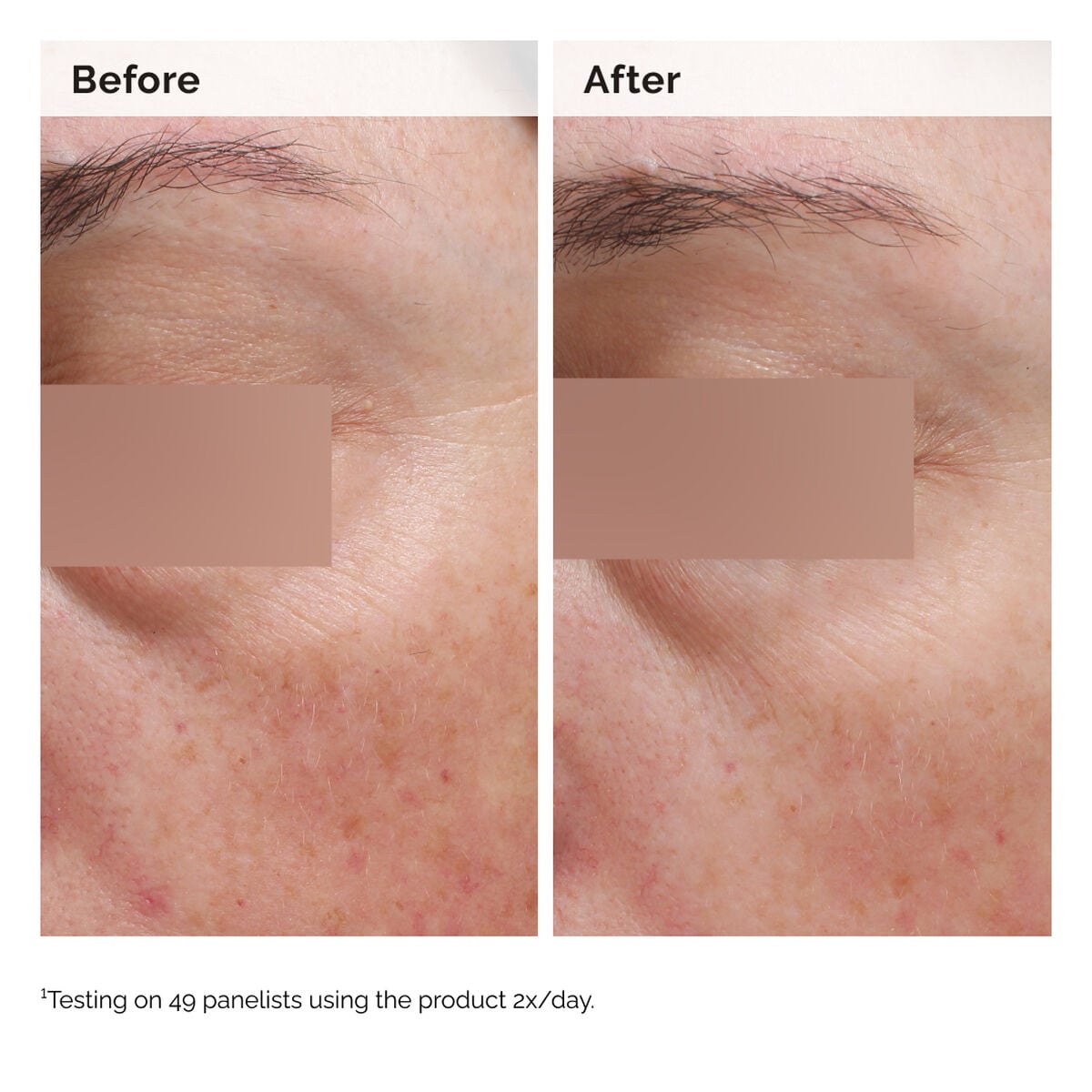 niacinamide-5-face-and-body-emulsion-o3 2024-08-23-ORD-Nia-5pct-Face-Body-B-A-Elasticity-Global-02-1x1.jpg