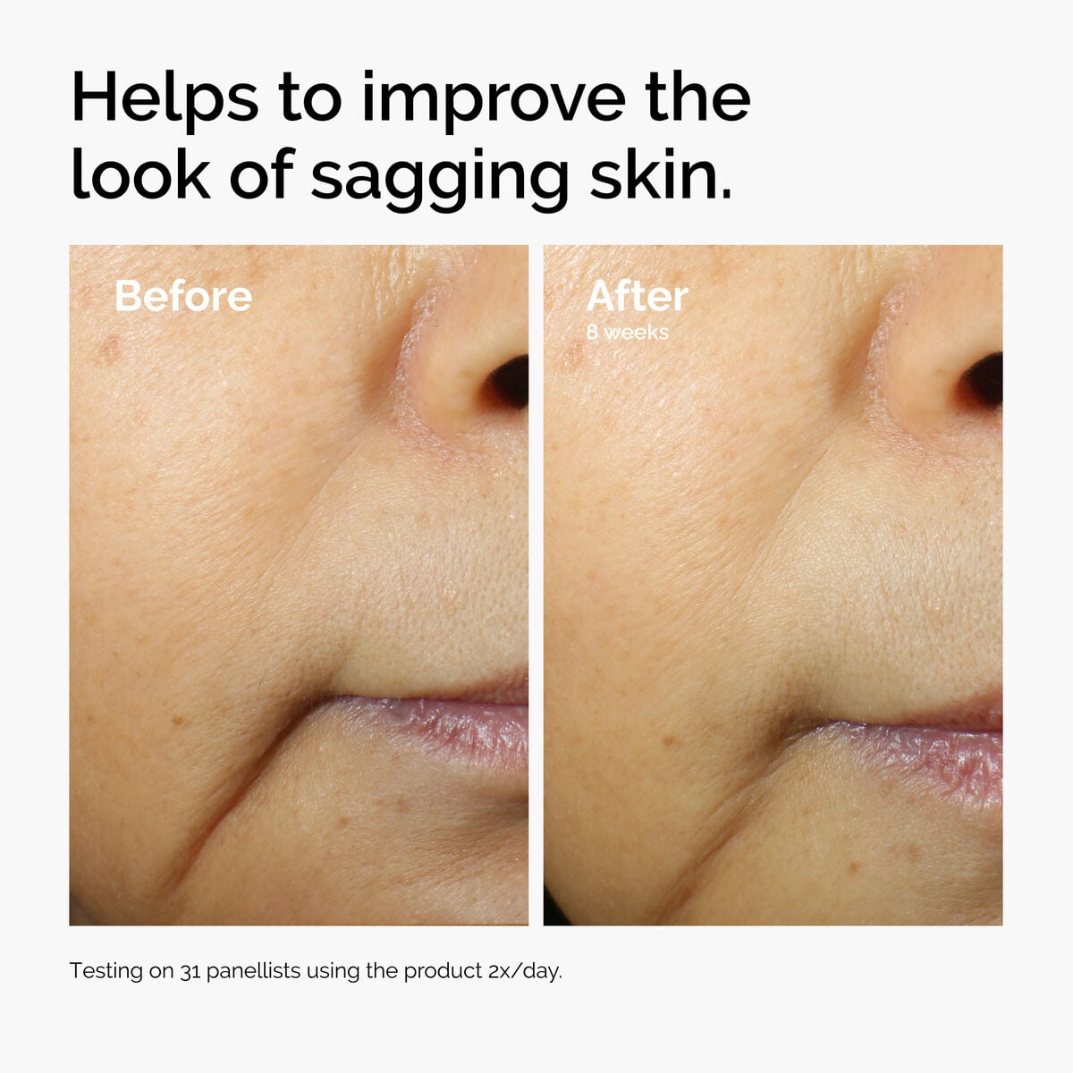 caffeine-3-escin-1-face-serum-i0 ord-caffeine-3pct-escin-1pct-face-serum-before-after-sagging.jpg