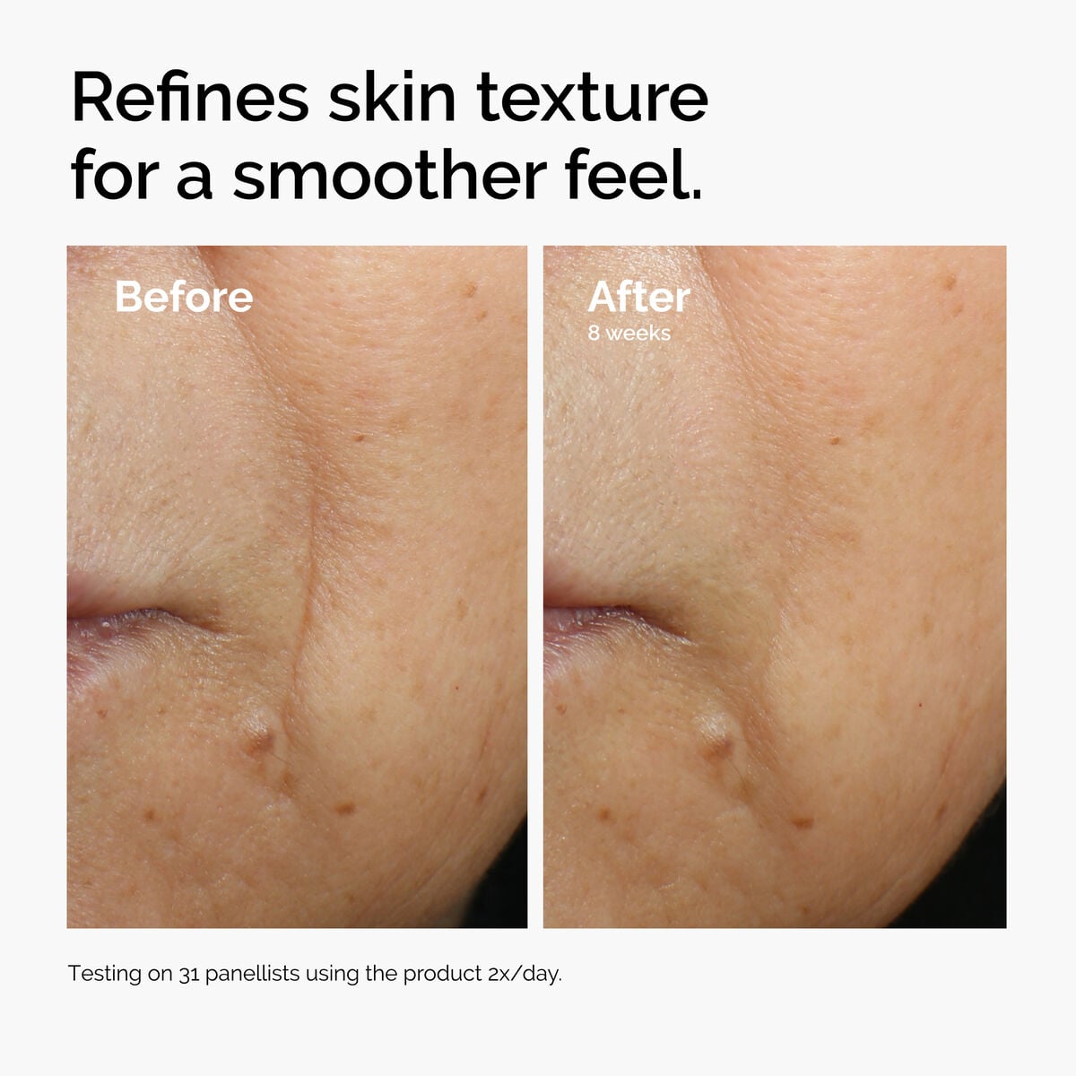 caffeine-3-escin-1-face-serum-i0 ord-caffeine-3pct-escin-1pct-face-serum-before-after-texture.jpg