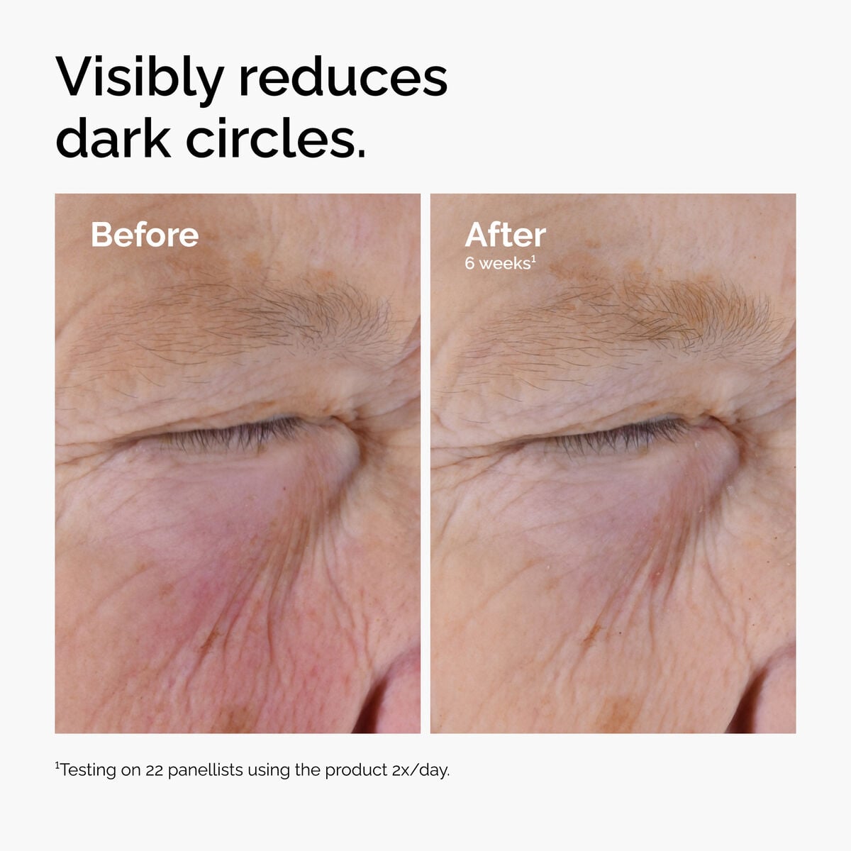 caffeine-solution-5-egcg-eye-serum-i3 ord-caffeine-solution-egcg-dark-circles-before-after.jpg