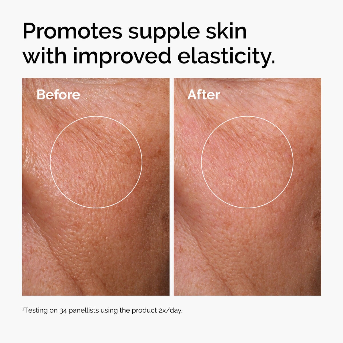 hyaluronic-acid-2-b5-with-ceramides-l3 ord-hyaluronic-acid-2pct-b5-hydrating-serum-before-after-elasticity.jpg