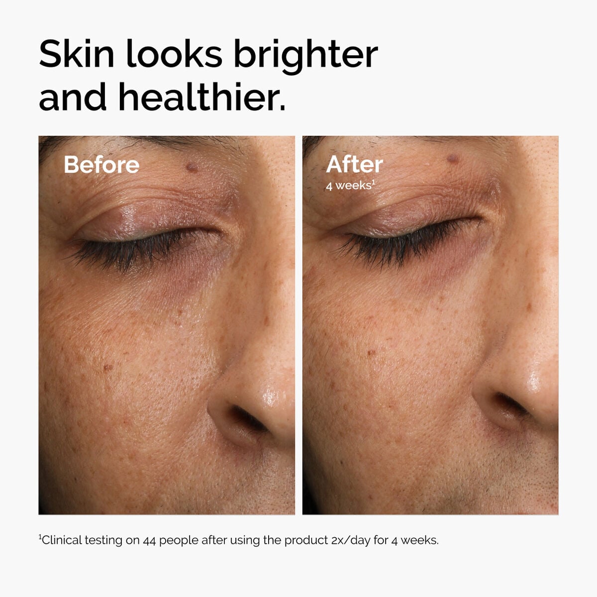 multi-antioxidant-radiance-serum-j7 ord-mars-before-after-healthy.jpg