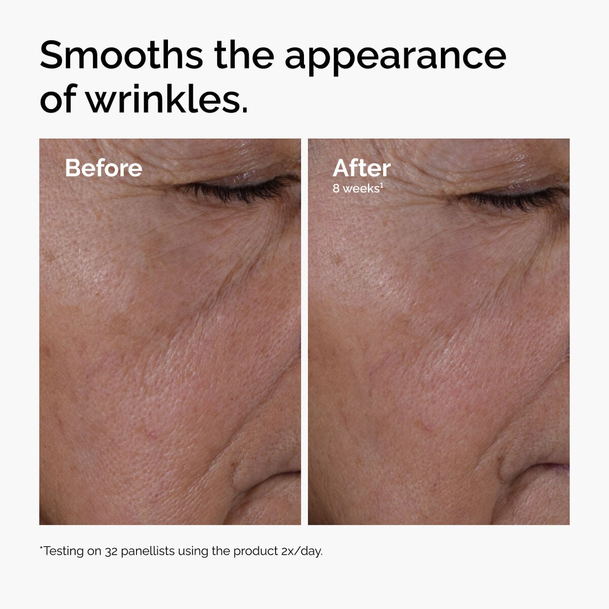 multi-peptide-ha-serum-v8 ord-multi-peptide-ha-serum-wrinkles-before-after.jpg