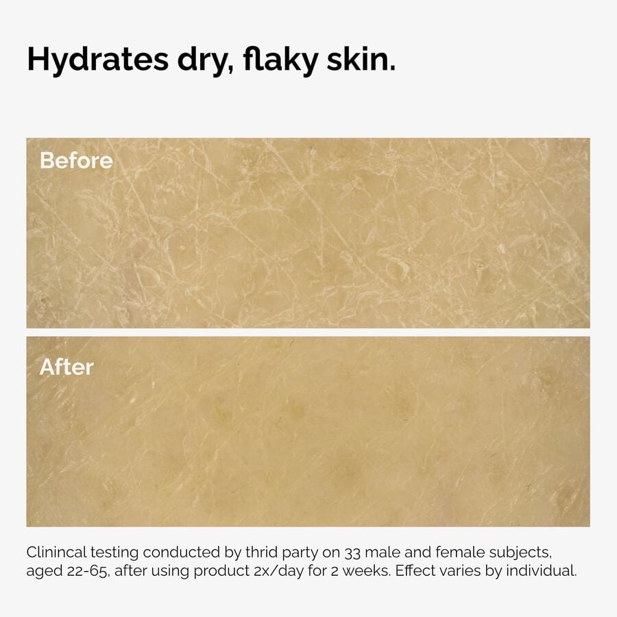 the-body-care-collection-b8 ord-natural-moisturizing-factors-inulin-body-before-after-graphic-02.jpg