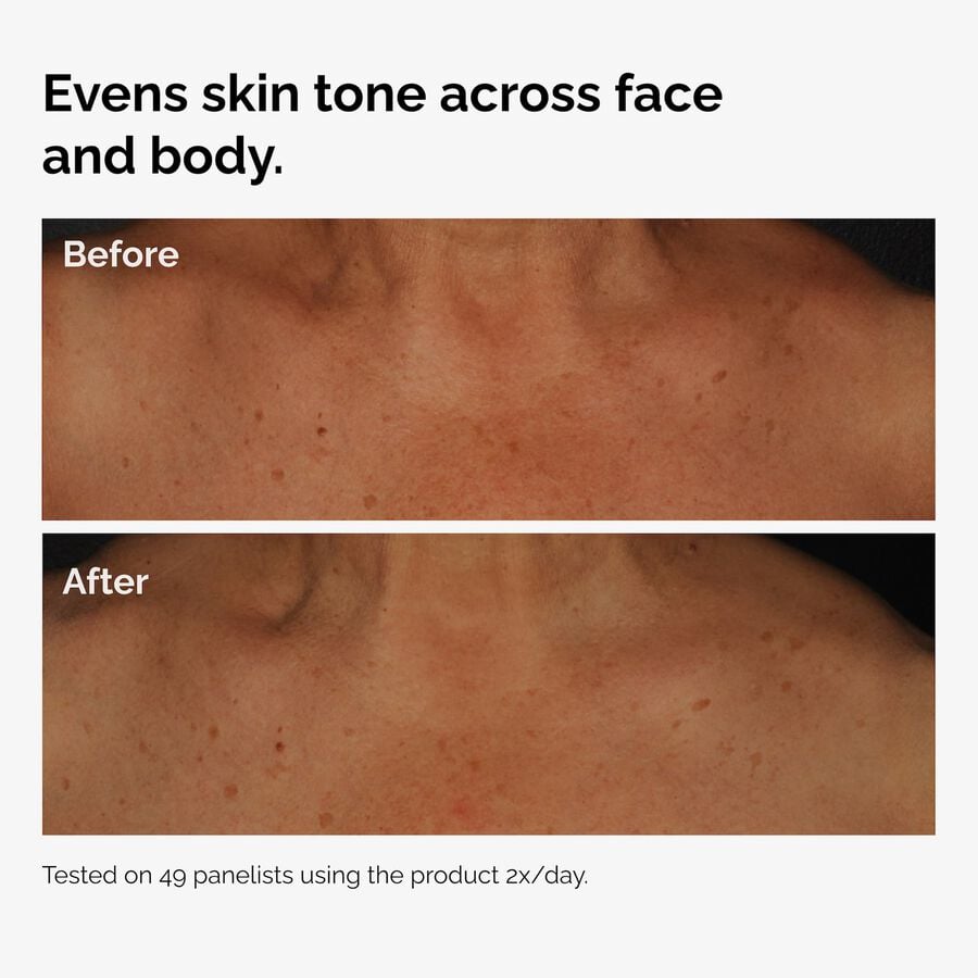 the-body-care-collection-b8 ord-niacinamide-face-body-serum-before-after-even-tone-graphic.jpg