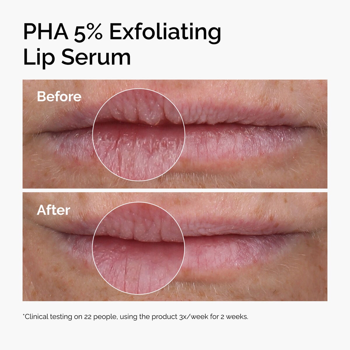 pha-5-exfoliating-lip-serum-q1 ord-pha-5pct-lip-exfoliating-serum-before-after.jpg
